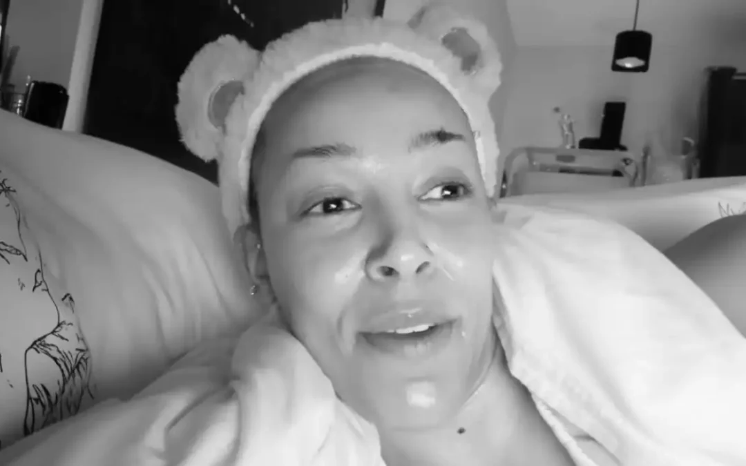 Doja Cat Shares Lipedema Diagnosis